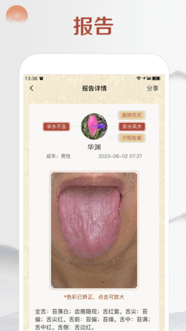 看舌头 3.3.13  3