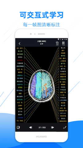 影像解剖图谱 4.4.1 最新版 1