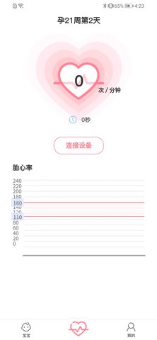 fetalheart胎心仪 1.1.839 安卓版 1