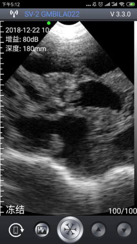 智能B超 3.8.7 安卓版 2