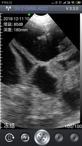 智能B超 3.8.7 安卓版 1