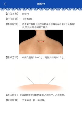 蒙医穴位标准化信息系统 1.0 安卓版 2