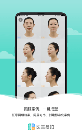 医美易拍 2.0.3 安卓版 3