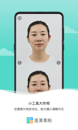 医美易拍 2.0.3 安卓版 2