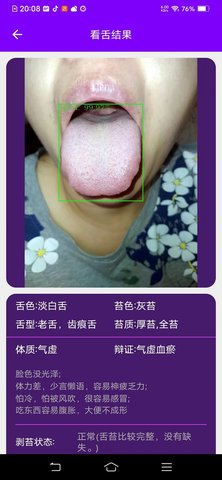 AI看舌 1.0.0 安卓版 3