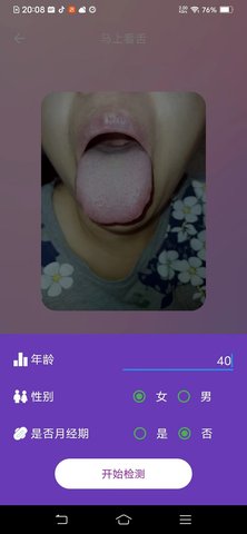AI看舌 1.0.0 安卓版 2