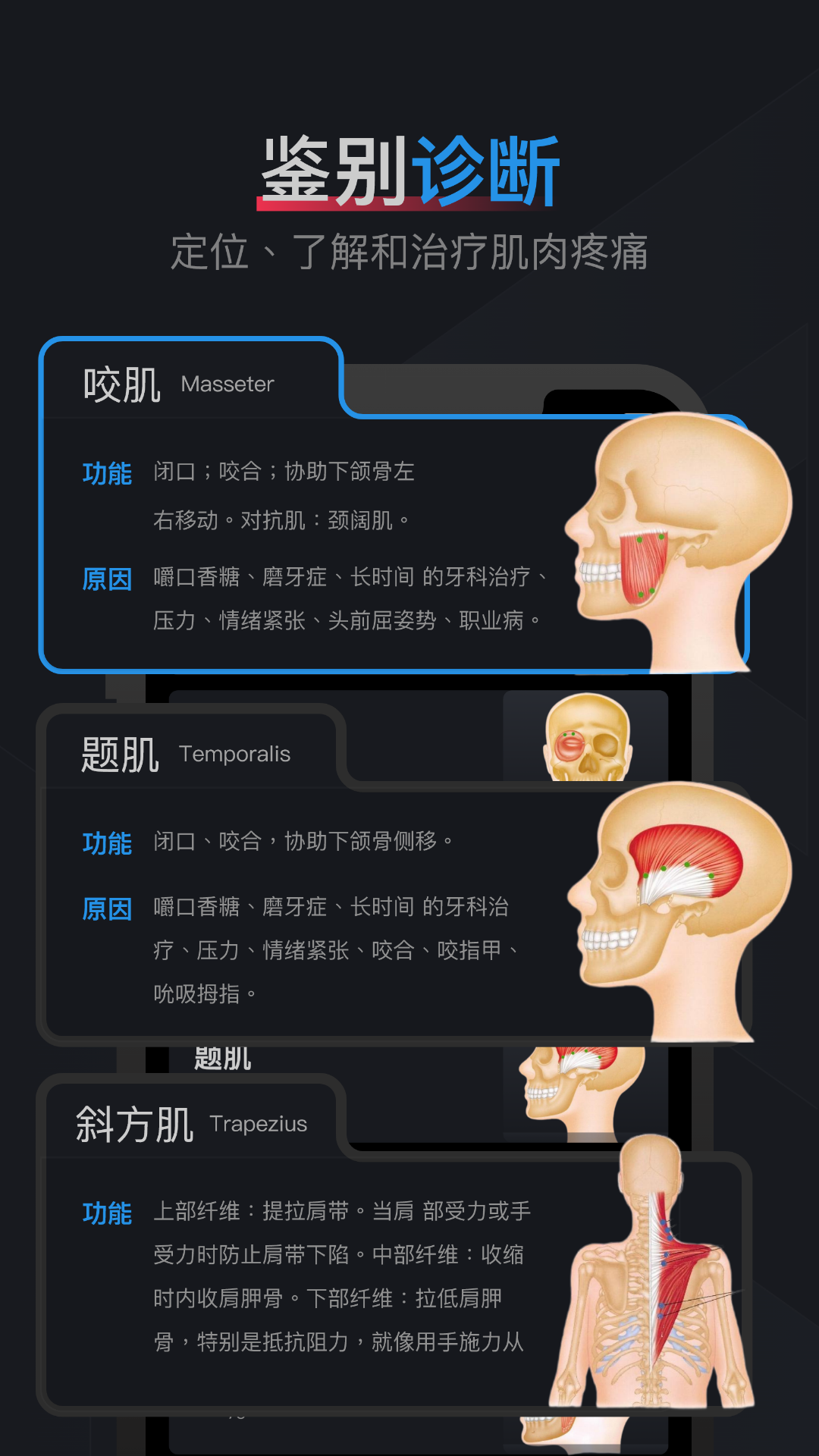 肌肉激痛点图谱 1.2 最新版 1