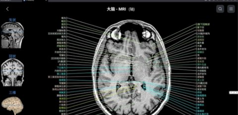eAnatomy 7.4.15 安卓版 1