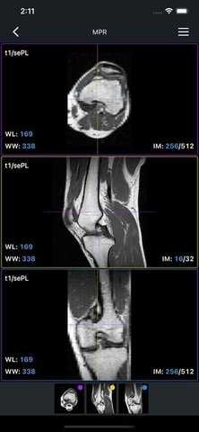 IDV影像 2.3.6 安卓版 2