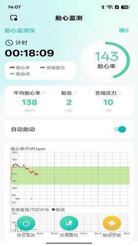 喜芽Pro 2.0.5 安卓版 1