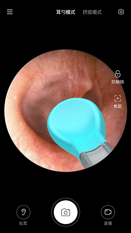 xlife可视耳勺安装 1.0.60 安卓版 2